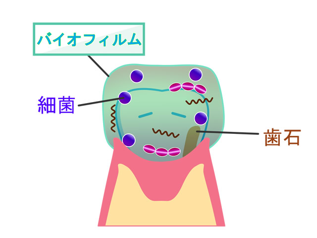バイオフィルム